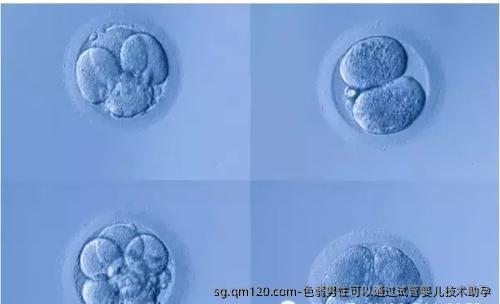 色弱男性可以通过试管婴儿技术助孕