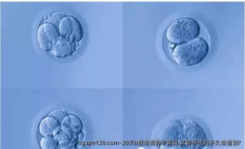 20天b超能看到孕囊吗,试管移植后多久能看到?