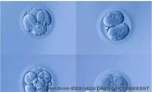 试管婴儿nt后除了两种情况外可以不用黄体支持了