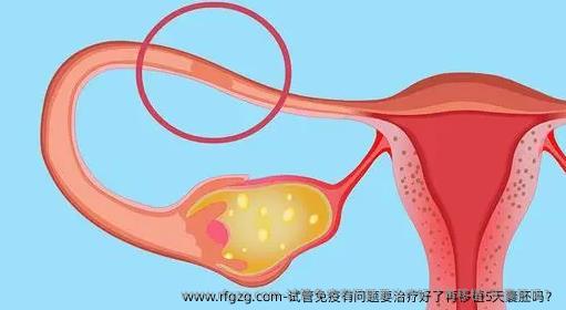 试管免疫有问题要治疗好了再移植5天囊胚吗？