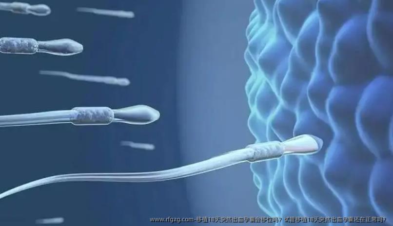 移植18天突然出血孕囊会移位吗？试管移植18天突然出血孕囊还在正常吗？
