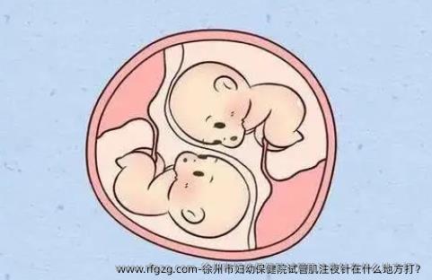 徐州市妇幼保健院试管肌注夜针在什么地方打？