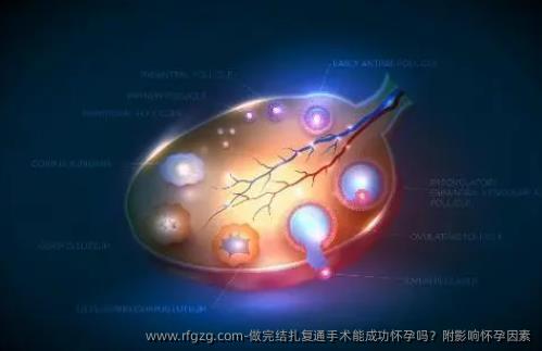 做完结扎复通手术能成功怀孕吗？附影响怀孕因素