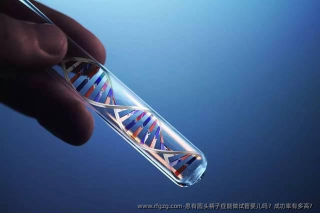 患有圆头精子症能做试管婴儿吗？成功率有多高？