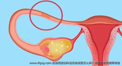 成都西囡妇科医院做试管怎么样？附四川试管费用明细