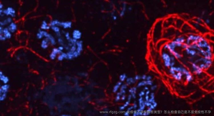 免疫性不孕有哪些类型？怎么检查自己是不是免疫性不孕