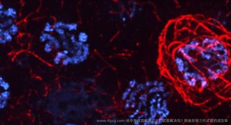 地中海贫血能通过三代试管解决吗？附地贫做三代试管的成功率