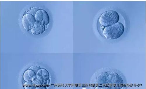 广州医科大学附属第三医院做第二代试管婴儿的价格是多少？