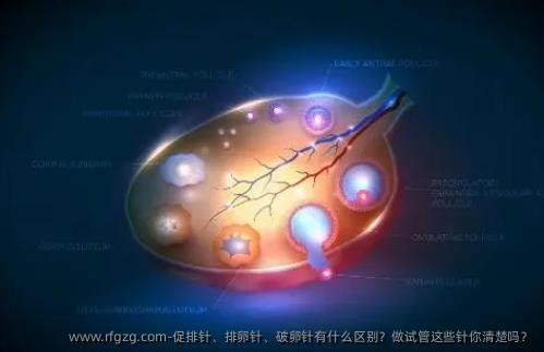 促排针、排卵针、破卵针有什么区别？做试管这些针你清楚吗？