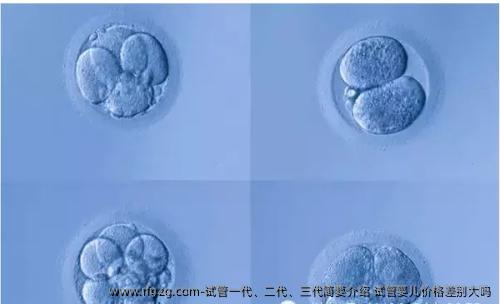 试管一代、二代、三代简要介绍 试管婴儿价格差别大吗