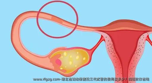 湖北省妇幼保健院三代试管的费用是多少？四招教你省钱