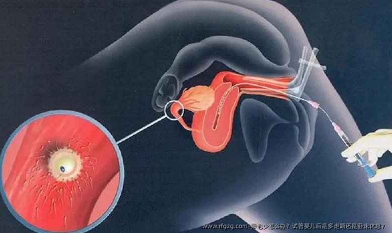 卵泡少怎么办？试管婴儿后是多走路还是卧床休息？