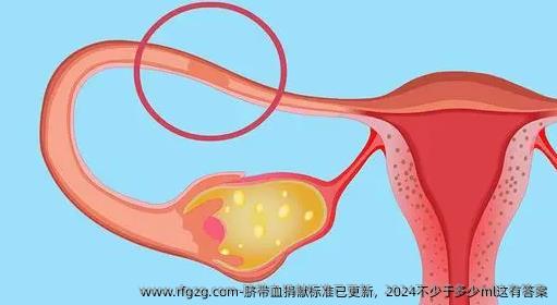 脐带血捐献标准已更新，2024不少于多少ml这有答案