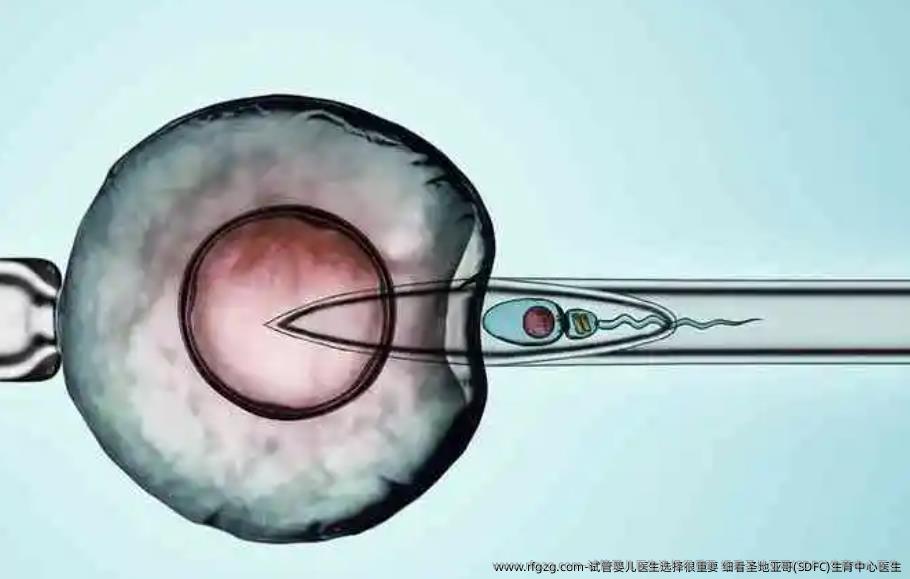 试管婴儿医生选择很重要 细看圣地亚哥(SDFC)生育中心医生