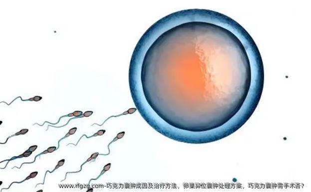 巧克力囊肿成因及治疗方法，卵巢异位囊肿处理方案，巧克力囊肿需手术否？