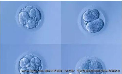 潮州市试管婴儿全攻略：节省费用的单周期试管与费用解读