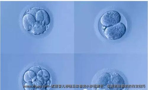 试管婴儿移植后助着床小妙招解析：促进胚胎着床的有效技巧