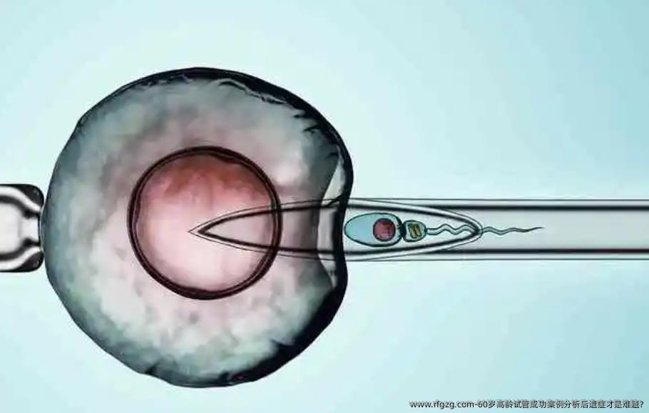 60岁高龄试管成功案例分析后遗症才是难题?