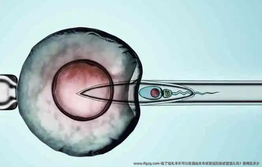 做了结扎手术可以在嘉峪关市试管医院做试管婴儿吗？费用是多少