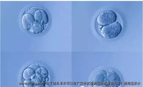 做了结扎手术可以在广汉市试管医院做试管婴儿吗？费用是多少