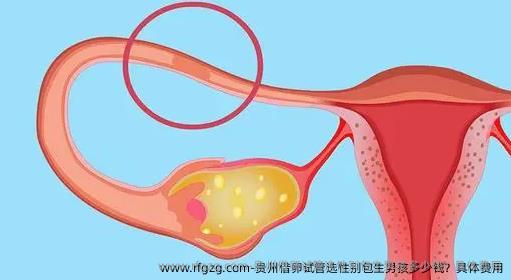 贵州特需试管选择多少钱？具体费用