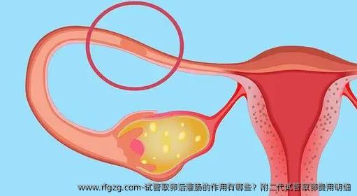 试管取卵后灌肠的作用有哪些？附二特需费用明细