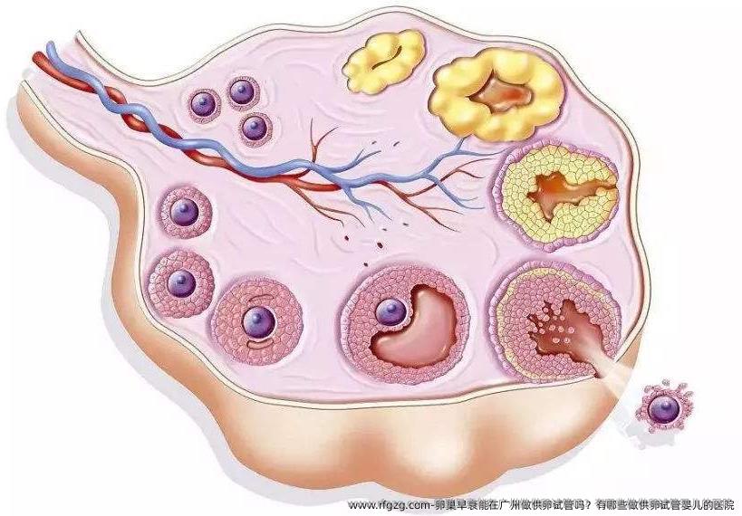 卵巢早衰能在广州做特需试管吗？有哪些做特需试管婴儿的医院