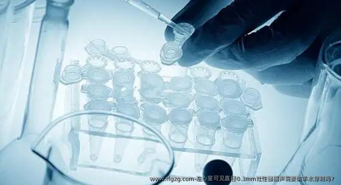 左心室可见直径0.3mm灶性强回声需要做羊水穿刺吗？