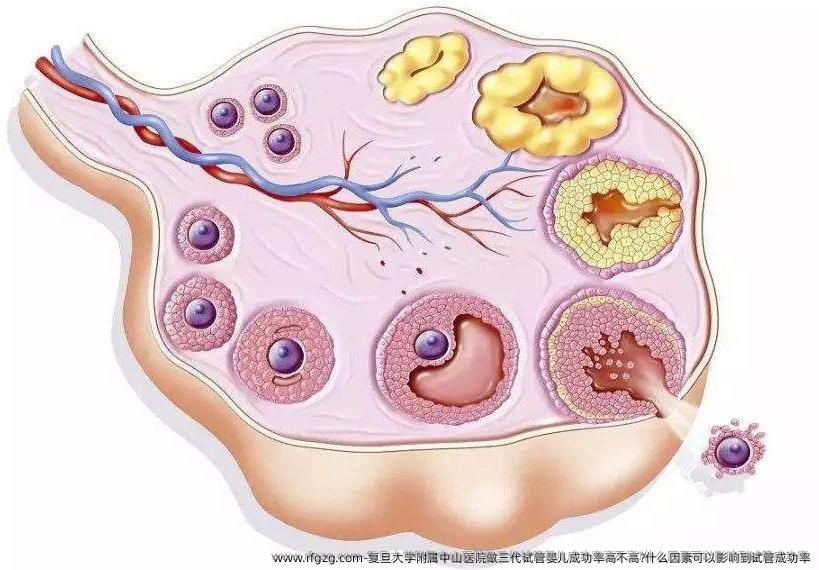 复旦大学附属中山医院做三代试管婴儿成功率高不高?什么因素可以影响到试管成功率