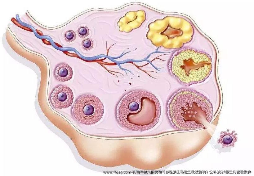 死精率80%的男性可以在洪江市做三代试管吗？公开2024做三代试管条件