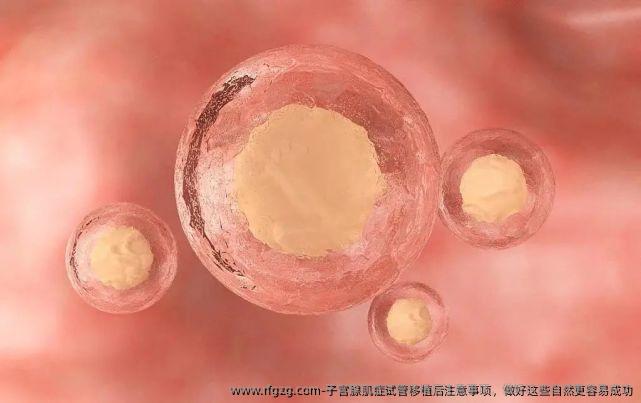 子宫腺肌症试管移植后注意事项，做好这些自然更容易成功