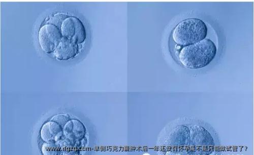 单侧巧克力囊肿术后一年还没有怀孕是不是只能做试管了？