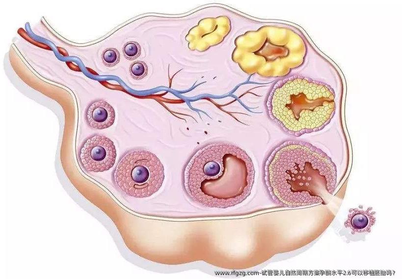 试管婴儿自然周期方案孕酮水平2.6可以移植胚胎吗？