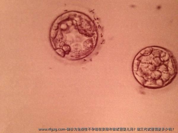 确诊为免疫性不孕能在安阳市做试管婴儿吗？做三代试管需要多少钱？