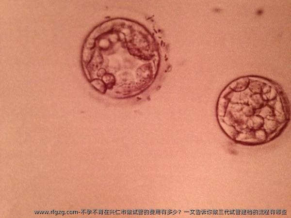 不孕不育在兴仁市做试管的费用有多少？一文告诉你做三代试管建档的流程有哪些