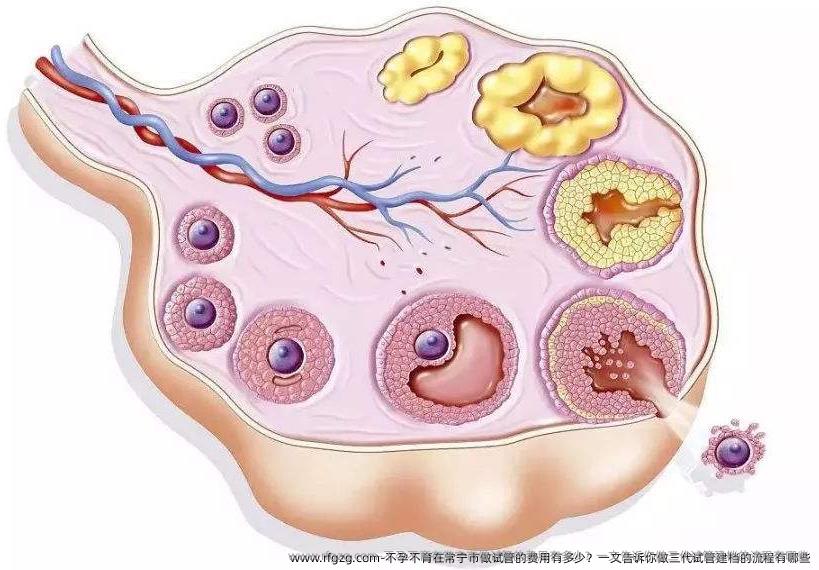 不孕不育在常宁市做试管的费用有多少？一文告诉你做三代试管建档的流程有哪些