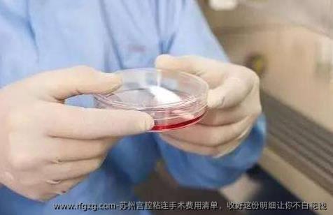 苏州宫腔粘连手术费用清单，收好这份明细让你不白花钱