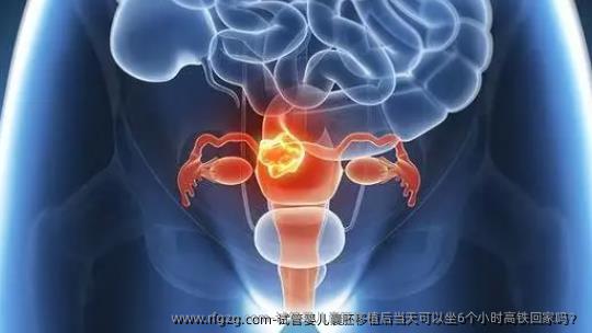 试管婴儿囊胚移植后当天可以坐6个小时高铁回家吗？