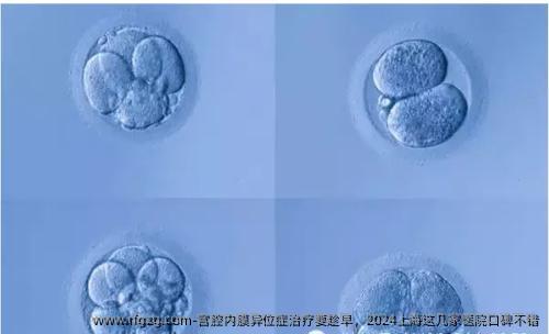 宫腔内膜异位症治疗要趁早，2024上海这几家医院口碑不错