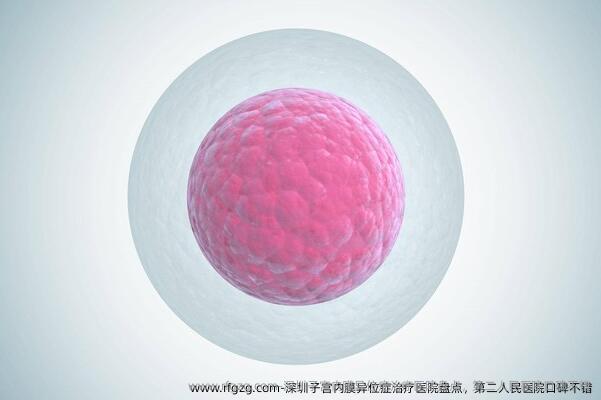 深圳子宫内膜异位症治疗医院盘点，第二人民医院口碑不错