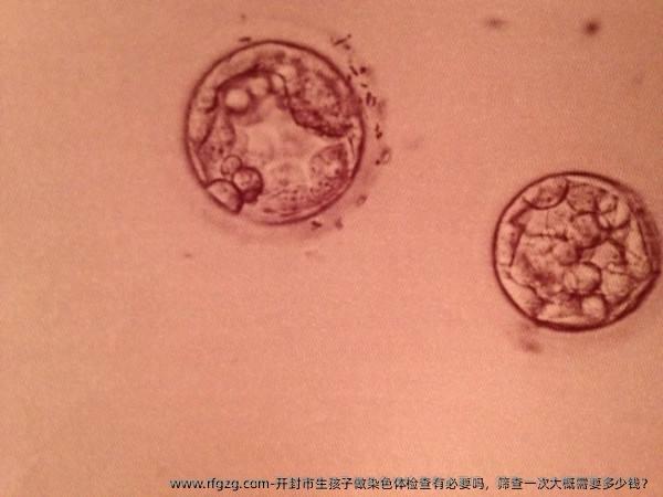 开封市生孩子做染色体检查有必要吗，筛查一次大概需要多少钱？