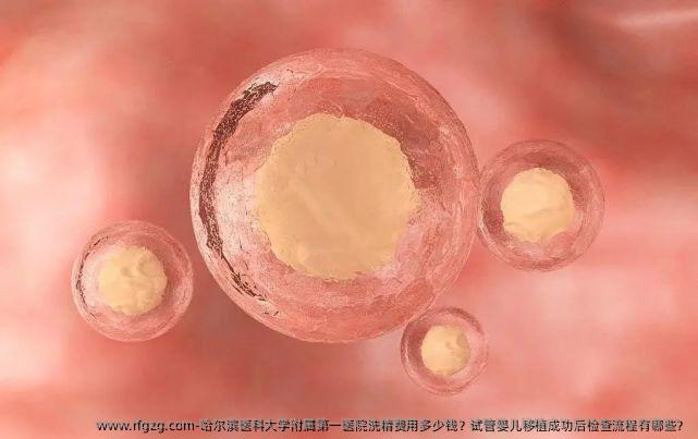 哈尔滨医科大学附属第一医院洗精费用多少钱？试管婴儿移植成功后检查流程有哪些？