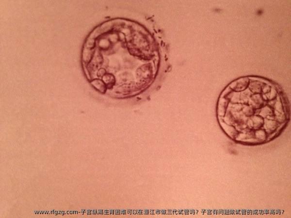 子宫纵隔生育困难可以在潜江市做三代试管吗？子宫有问题做试管的成功率高吗？