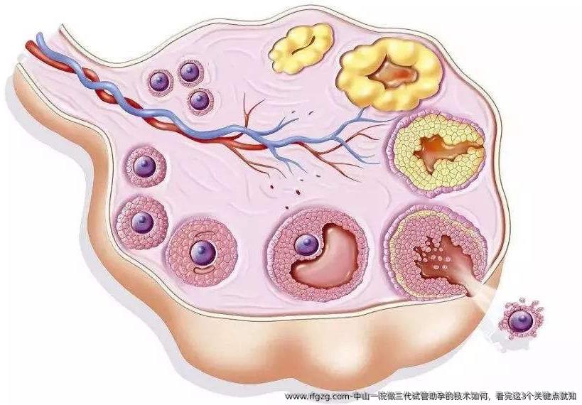 中山一院做三代试管助孕的技术如何，看完这3个关键点就知