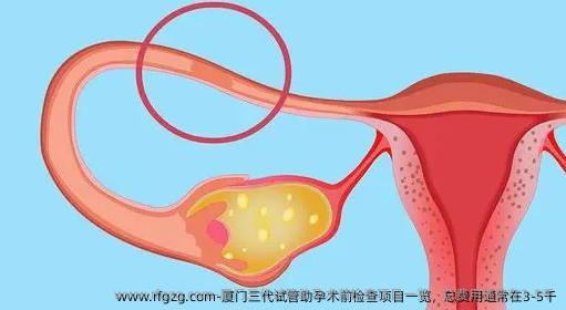 厦门三代试管助孕术前检查项目一览，总费用通常在3-5千