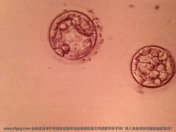 染色体异常不孕能在铜陵市妇幼保健院做三代试管怀孩子吗？男人染色体有问题能做试管吗？