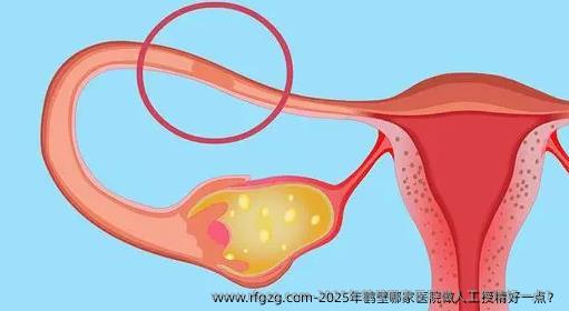 2025年鹤壁哪家医院做人工授精好一点？