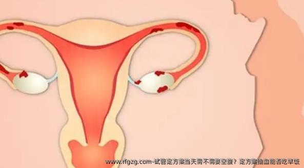 试管定方案当天需不需要空腹？定方案抽血能否吃早饭