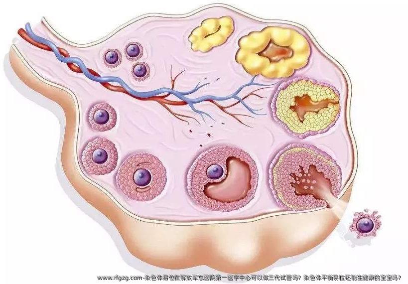 染色体易位在解放军总医院第一医学中心可以做三代试管吗？染色体平衡易位还能生健康的宝宝吗？