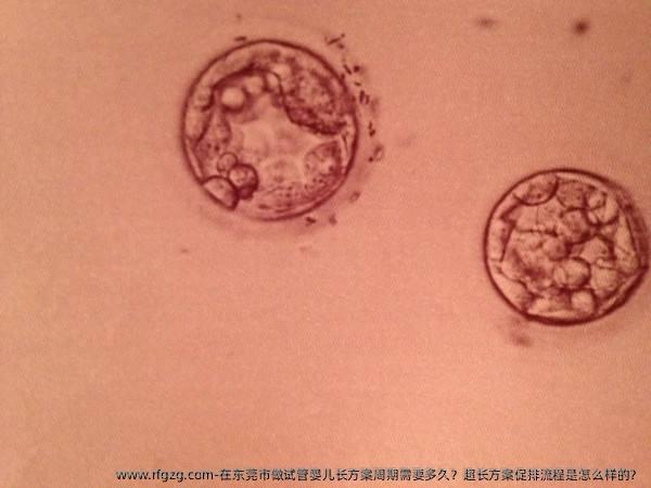 在东莞市做试管婴儿长方案周期需要多久？超长方案促排流程是怎么样的？